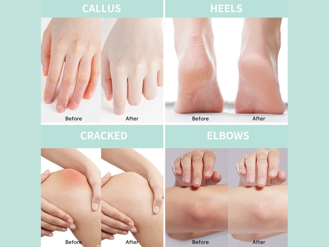 Tunmate Hand And Foot Urea Cream Color Box Edition 150g