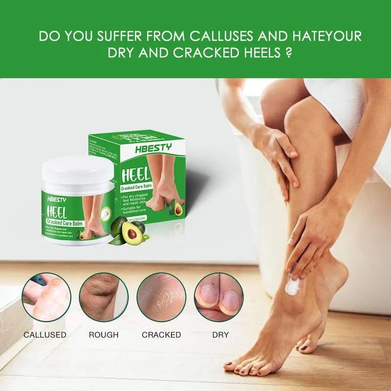 Avocado Heel Cracking Cream - Semoor Make Me Fit