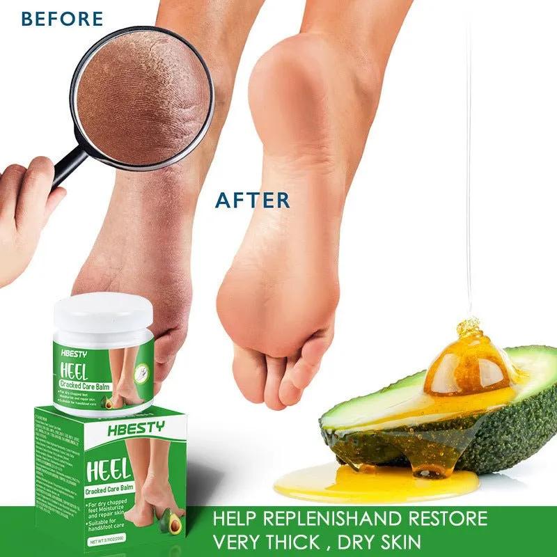 Avocado Heel Cracking Cream - Semoor Make Me Fit