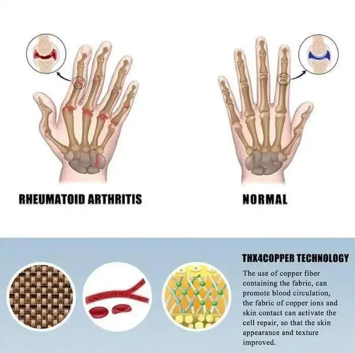 Joint Ease Arthritis Gloves - Semoor Make Me Fit